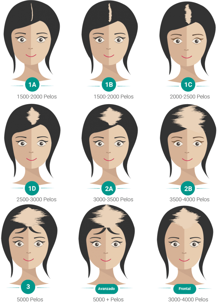Asset 1@referencia-femenina Asset 1@referencia-femenina