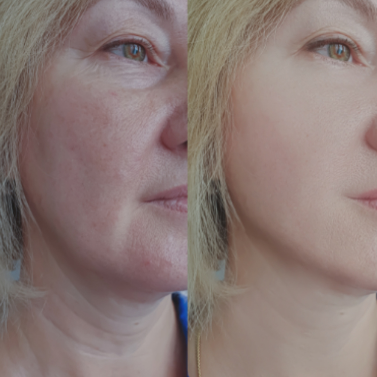 resultados 1 - Inicio - The Aesthetic Group